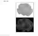 Fig. 19 - THREE-DIMENSIONAL BIOPRINTED PANCREATIC TUMOR MODEL