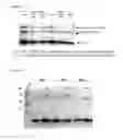 Fig. 06 - Virus like particle comprising modified envelope protein E3