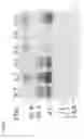 Fig. 05 - Purification of recombinant alpha galactosidase A