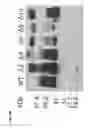 Fig. 06 - Purification of recombinant alpha galactosidase A