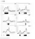 Fig. 16 - Purification of recombinant alpha galactosidase A