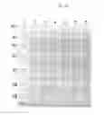 Fig. 10 - Novel Polypeptides Having Endolysin Activity and Uses Thereof