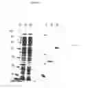 Fig. 31 - Novel Polypeptides Having Endolysin Activity and Uses Thereof