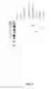 Fig. 04 - Methods for purification of messenger RNA