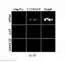 Fig. 22 - siRNA-mediated gene silencing