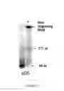 Fig. 06 - Selection of RNA-aptamers as anti-malaria agents