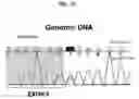 Fig. 04 - Mutations in DSTYK cause dominant urinary tract malformations