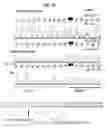 Fig. 05 - Mutations in DSTYK cause dominant urinary tract malformations
