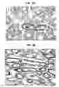 Fig. 09 - Mutations in DSTYK cause dominant urinary tract malformations