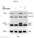 Fig. 15 - Mutations in DSTYK cause dominant urinary tract malformations