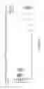 Fig. 06 - CIRCULATING TUMOR CELL DIAGNOSTICS FOR DETECTION OF NEUROENDOCRINE PROSTATE CANCER (NEPC)