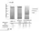 Fig. 09 - PROGNOSTIC AND DIAGNOSTIC METHODS BASED ON QUANTIFICATION OF SOMATIC MICROSATELLITE VARIABILITY