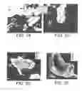 Fig. 10 - Method for preparing a carbide ceramics multilayer coating on, and optionally in, a part made of a carbon-containing material using a reactive melt infiltration RMI technique