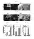 Fig. 11 - METHOD OF MANUFACTURING POROUS THREE-DIMENSIONAL MICRO/NANOFIBROUS SCAFFOLD USING ELECTROHYDRODYNAMIC PROCESS AND POROUS THREE-DIMENSIONAL MICRO/NANOFIBROUS SCAFFOLD MANUFACTURED THEREBY