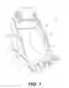 Fig. 02 - Retention system for a wear member