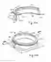 Fig. 26 - Extendable sleeve for poured concrete deck