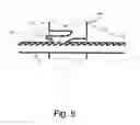 Fig. 05 - Faade wall attachment device