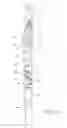 Fig. 10 - Handle for a door or window with two or three point latch