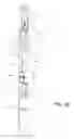 Fig. 11 - Handle for a door or window with two or three point latch