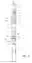 Fig. 12 - Handle for a door or window with two or three point latch