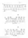 Fig. 14 - System and method for controlling linear movement using a tapered MR valve