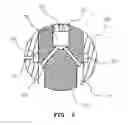 Fig. 09 - Electronically controlled fuel injection valve