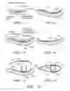 Fig. 04 - METHODS OF MANUFACTURING ROTOR BLADES OF A WIND TURBINE