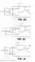 Fig. 05 - Attachment system for an electronic device
