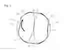 Fig. 03 - Silent chain