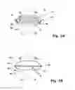 Fig. 02 - Bevel gear having modified geometry