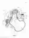 Fig. 02 - MECHANICAL PIPE FITTING