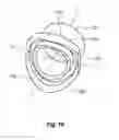 Fig. 14 - MECHANICAL PIPE FITTING