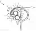 Fig. 01 - Fabric attachment system