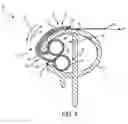 Fig. 05 - Fabric attachment system