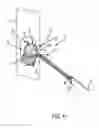 Fig. 07 - Fabric attachment system