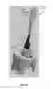 Fig. 12 - Electric lighting devices
