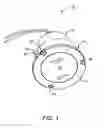 Fig. 02 - Concealer plate for a lighting fixture