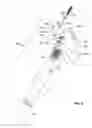 Fig. 05 - Single shot firearm