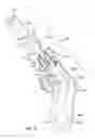 Fig. 10 - Single shot firearm