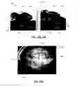 Fig. 31 - System and method for generating a wide-field OCT image of a portion of a sample