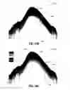 Fig. 34 - System and method for generating a wide-field OCT image of a portion of a sample