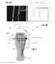 Fig. 04 - Smart phone attachment for 3-D optical coherence tomography imaging