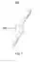 Fig. 07 - Small form factor pressure sensor