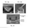 Fig. 14 - Methods and apparatus for trapping and size resolution of nanoparticles and nanobubbles