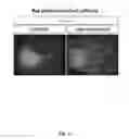 Fig. 33 - CELLULAR DISCOVERY PLATFORM FOR NEURODEGENERATIVE DISEASES