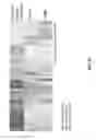 Fig. 15 - BIOMARKER COMPOSITIONS AND MARKERS