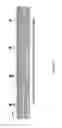 Fig. 10 - Biosensor microarray compositions and methods
