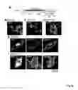 Fig. 13 - ANTIBODIES AGAINST ACTIN-BINDING PROTEIN GIRDIN AND METHODS OF MAKING AND USING THE SAME