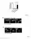 Fig. 17 - ANTIBODIES AGAINST ACTIN-BINDING PROTEIN GIRDIN AND METHODS OF MAKING AND USING THE SAME