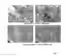 Fig. 34 - ANTIBODIES AGAINST ACTIN-BINDING PROTEIN GIRDIN AND METHODS OF MAKING AND USING THE SAME